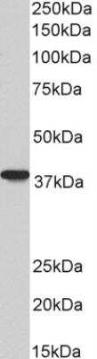 Western Blot: AIM2 Antibody (10M2B3) [NBP2-27355]