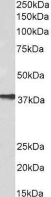 Western Blot: AIM2 Antibody (10M5G5)Azide and BSA Free [NBP2-80565]