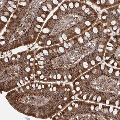 Immunohistochemistry-Paraffin: AIM2 Antibody [NBP1-87179]