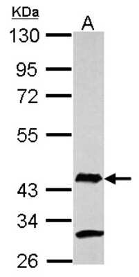 Western Blot: AIM2 Antibody [NBP2-15313]