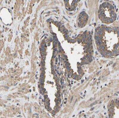 Immunohistochemistry-Paraffin: AIMP2 Antibody [NBP1-81575]