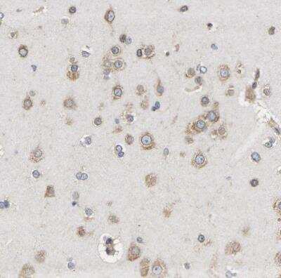 Immunohistochemistry-Paraffin: AIMP2 Antibody [NBP1-81575]