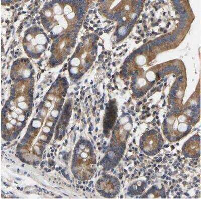 Immunohistochemistry-Paraffin: AIMP2 Antibody [NBP1-81575]