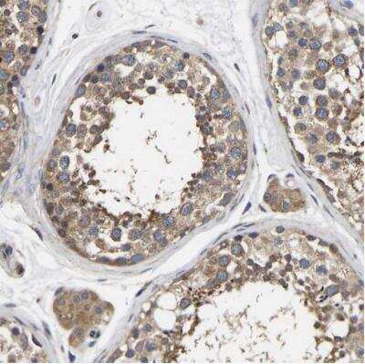 Immunohistochemistry-Paraffin: AIMP2 Antibody [NBP1-81575]