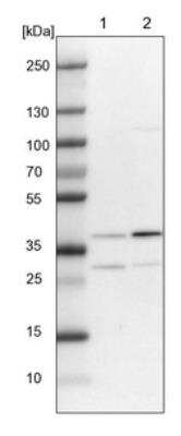Western Blot: AIMP2 Antibody [NBP1-81575]