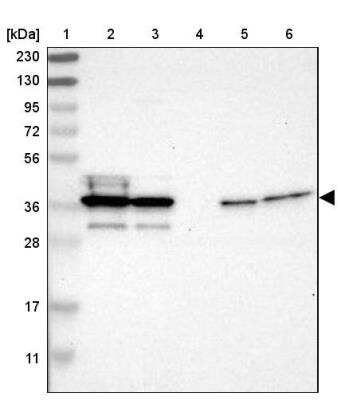 Western Blot: AIMP2 Antibody [NBP1-81575]