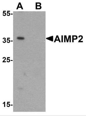 Western Blot: AIMP2 AntibodyBSA Free [NBP2-81885]