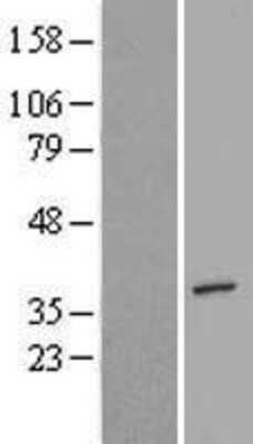 Western Blot: AIMP2 Overexpression Lysate [NBL1-12113]