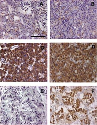 Immunohistochemistry: AIP/ARA9 Antibody (35-2) [NB100-127]