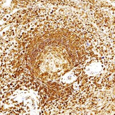 Immunohistochemistry-Paraffin: AIP/ARA9 Antibody (35-2) [NB100-127]