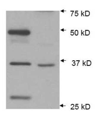 Western Blot: AIP/ARA9 Antibody (35-2) [NB100-127]