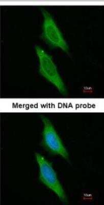 Immunocytochemistry/ Immunofluorescence: AIP/ARA9 Antibody [NBP1-31347]