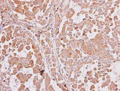Immunohistochemistry-Paraffin: AIP/ARA9 Antibody [NBP1-31347]