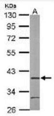 Western Blot: AIP/ARA9 Antibody [NBP1-31347]