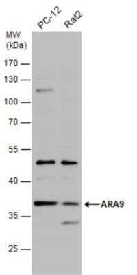 Western Blot: AIP/ARA9 Antibody [NBP1-31347]