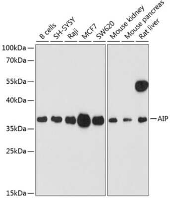 Western Blot: AIP/ARA9 AntibodyBSA Free [NBP2-92079]