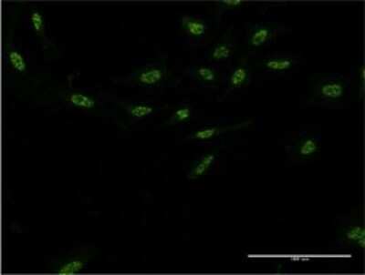 Immunocytochemistry/ Immunofluorescence: AIPL1 Antibody (1E1) [H00023746-M04]