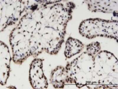 Immunohistochemistry-Paraffin: AIPL1 Antibody (1E1) [H00023746-M04]