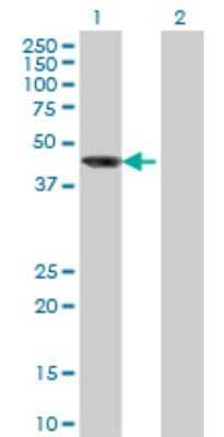 Western Blot: AIPL1 Antibody (1E1) [H00023746-M04]