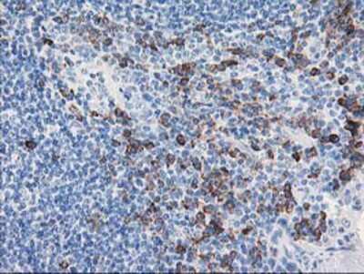 Immunohistochemistry-Paraffin: AIPL1 Antibody (OTI3B4) [NBP2-01327]