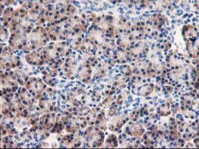 Immunohistochemistry-Paraffin: AIPL1 Antibody (OTI3B4) [NBP2-01327]