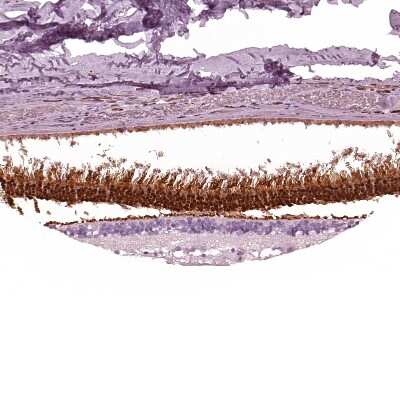 Immunohistochemistry-Paraffin: AIPL1 Antibody [NBP2-55506]