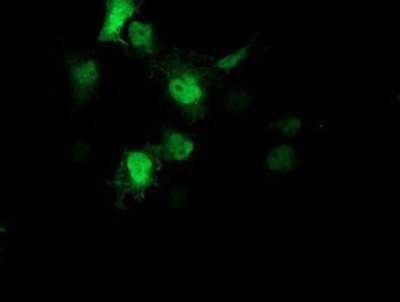 Immunocytochemistry/ Immunofluorescence: AIPL1 Antibody (OTI3B4) - Azide and BSA Free [NBP2-71775]