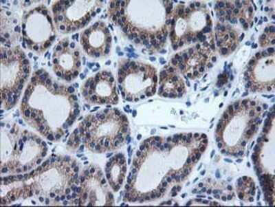 Immunohistochemistry: AIPL1 Antibody (OTI3B4) - Azide and BSA Free [NBP2-71775]