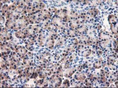 Immunohistochemistry: AIPL1 Antibody (OTI3B4) - Azide and BSA Free [NBP2-71775]