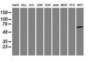 Western Blot: AIPL1 Antibody (OTI3B4)Azide and BSA Free [NBP2-71775]