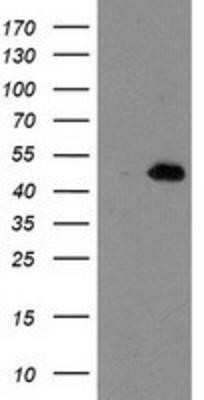 Western Blot: AIPL1 Antibody (OTI3B4)Azide and BSA Free [NBP2-71775]