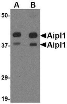 Western Blot: AIPL1 AntibodyBSA Free [NBP1-76956]