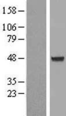 Western Blot: AIPL1 Overexpression Lysate [NBL1-07416]