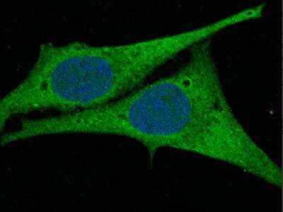 Immunocytochemistry/ Immunofluorescence: AK2 Antibody (009) [NBP2-90182]