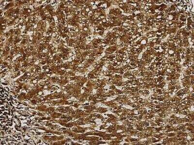 Immunohistochemistry-Paraffin: AK2 Antibody (025) [NBP2-90183]