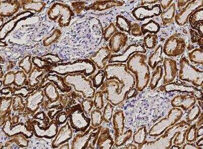 Immunohistochemistry-Paraffin: AK2 Antibody (025) [NBP2-90183]