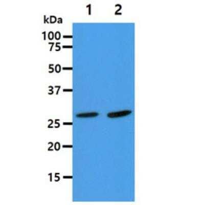 Western Blot: AK2 Antibody (AT7E7)BSA Free [NBP2-50575]