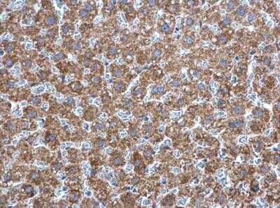 Immunohistochemistry-Paraffin: AK2 Antibody [NBP1-33160]