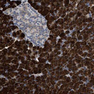 Immunohistochemistry-Paraffin: AK2 Antibody [NBP1-86043]