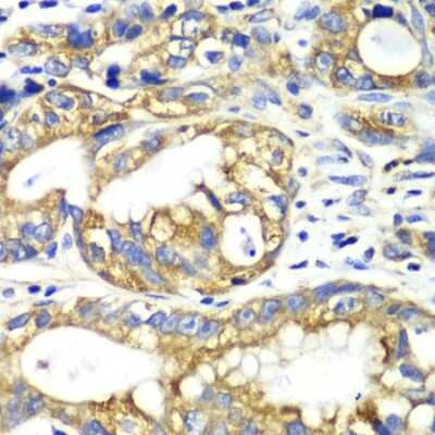 Immunohistochemistry-Paraffin: AK2 Antibody - BSA Free [NBP2-92954]