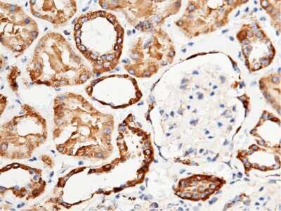 Immunohistochemistry-Paraffin: AK2 Antibody [NBP2-99896]