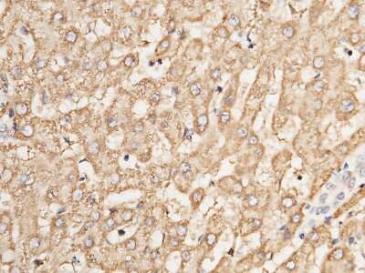Immunohistochemistry-Paraffin: AK2 Antibody [NBP2-99896]