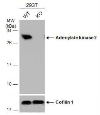 Western Blot: AK2 Antibody [NBP1-33160]