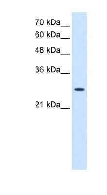 Western Blot: AK2 Antibody [NBP1-54639]