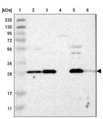 Western Blot: AK2 Antibody [NBP1-86043]