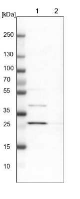 Western Blot: AK2 Antibody [NBP1-86043]