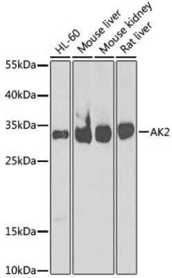 Western Blot: AK2 AntibodyBSA Free [NBP2-92954]