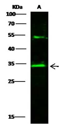 Western Blot: AK2 Antibody [NBP3-00075]