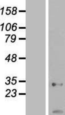 Western Blot: AK2 Overexpression Lysate [NBL1-07418]