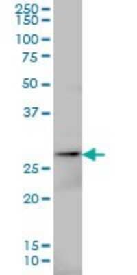 Western Blot: AK3 Antibody (1D2) [H00050808-M01]